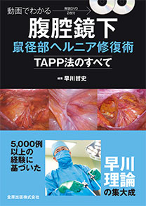 動画でわかる腹腔鏡下鼠径部ヘルニア修復術ーTAPP法のすべてー