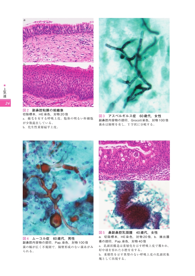 細胞診ガイドライン 4 呼吸器・胸腺・体腔液・リンパ節 2015年版