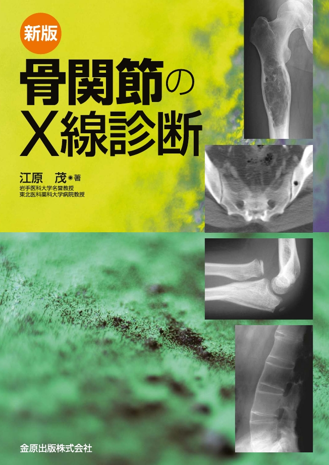 Amazon.co.jp: 骨・関節のX線診断 : 江原 茂: Japanese Books
