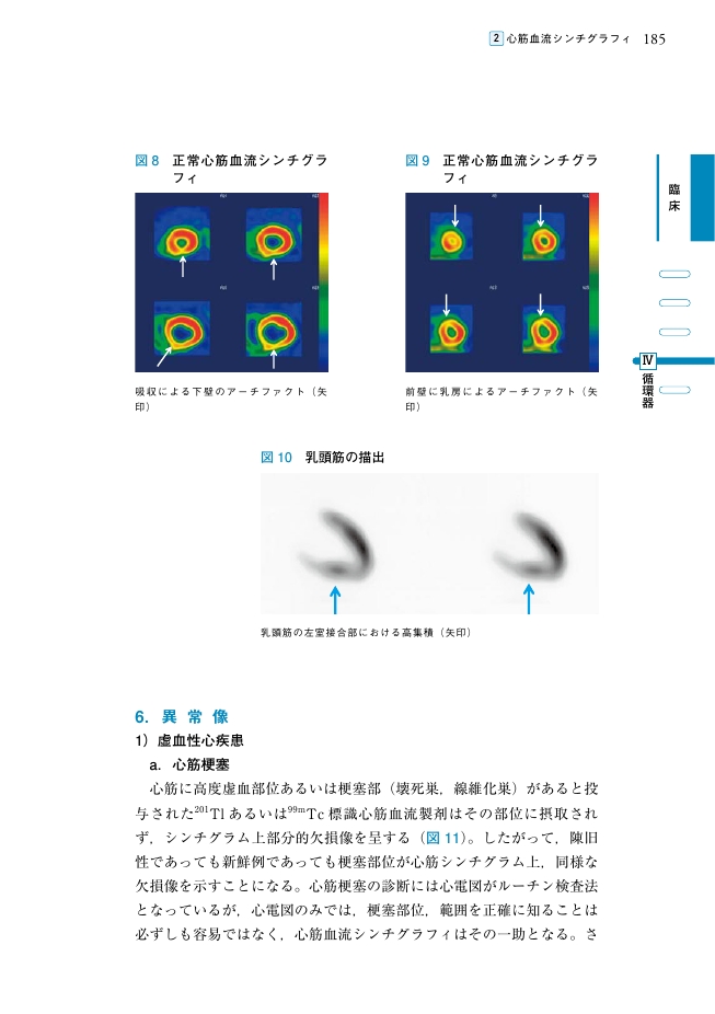 【裁断済】新 核医学テキスト 新 核医学テキスト | 絹谷 清剛, 若林 大志 |本 | 通販 | Amazon