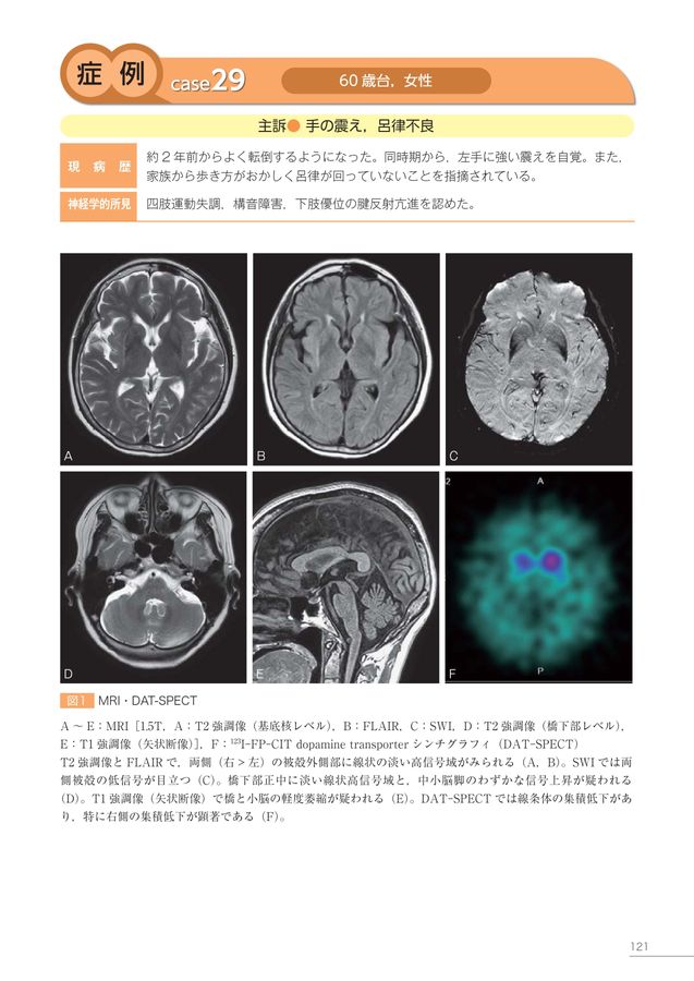 神経疾患のMRI | 高橋 睦正 |本 | 通販 | Amazon