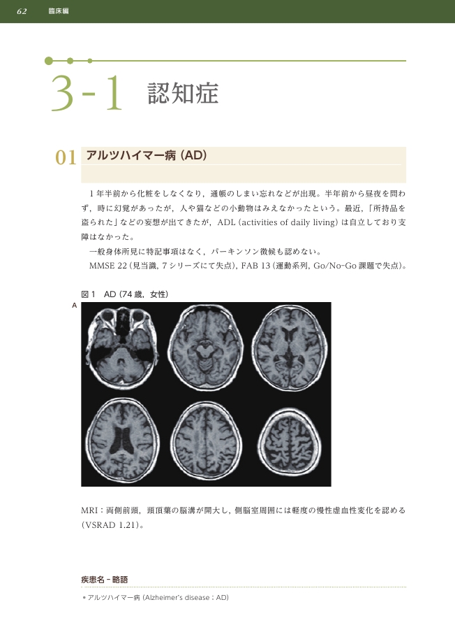 認知症・パーキンソン症候群 臨床と画像との対応