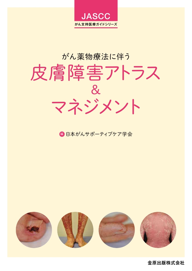 がん薬物療法に伴う皮膚障害アトラス＆マネジメント