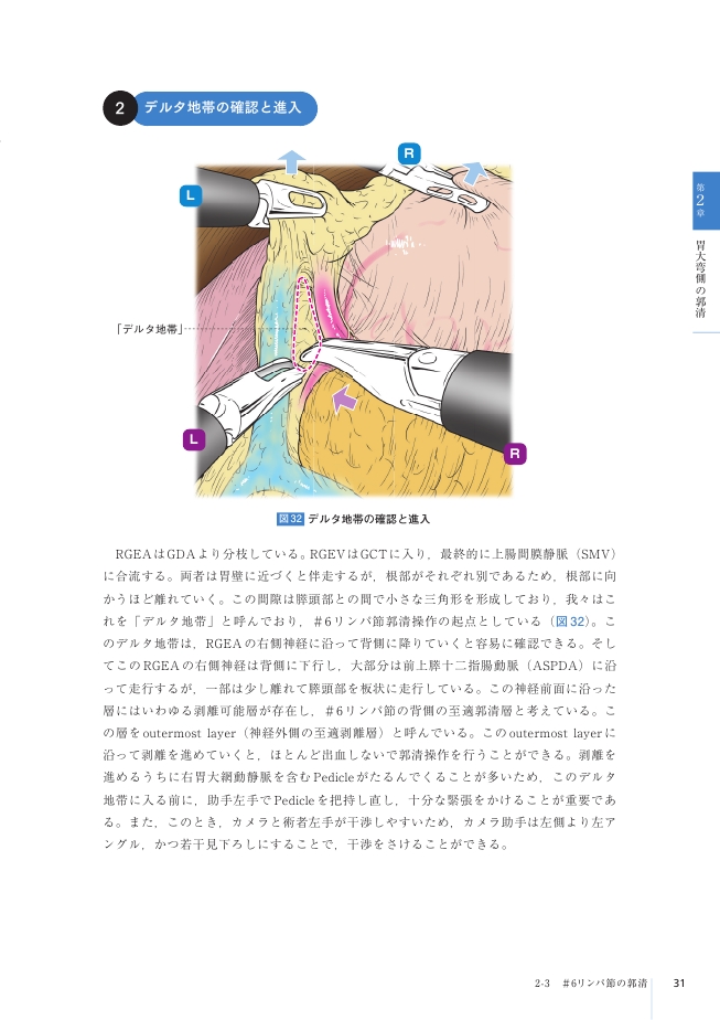 FUJITAS TEXT1 腹腔鏡下幽門側胃切除