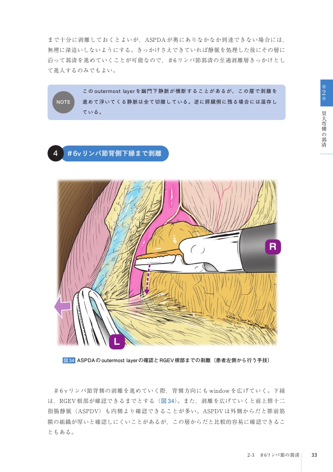 FUJITAS TEXT1 腹腔鏡下幽門側胃切除