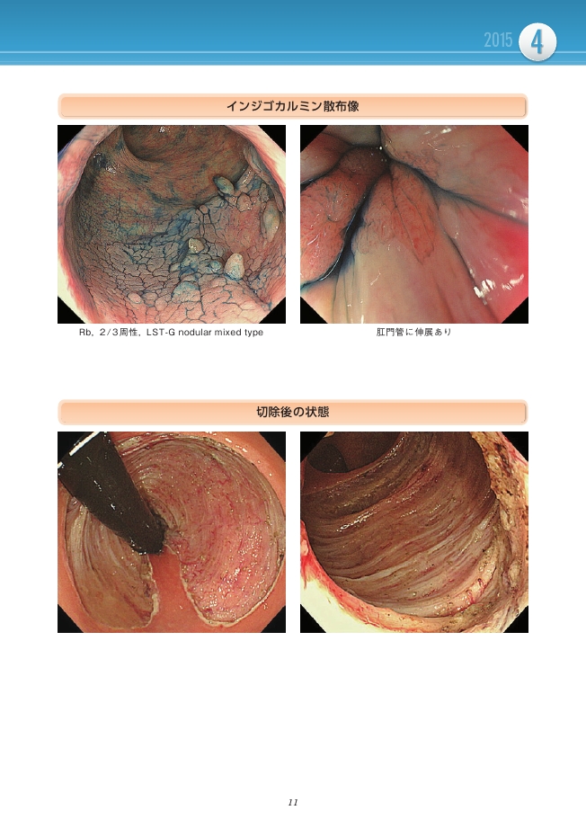 近畿 Live Endoscopy 2015-2016（DVD付き）