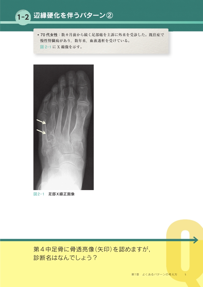 骨軟部腫瘍と腫瘍様病変の画像診断Q&A