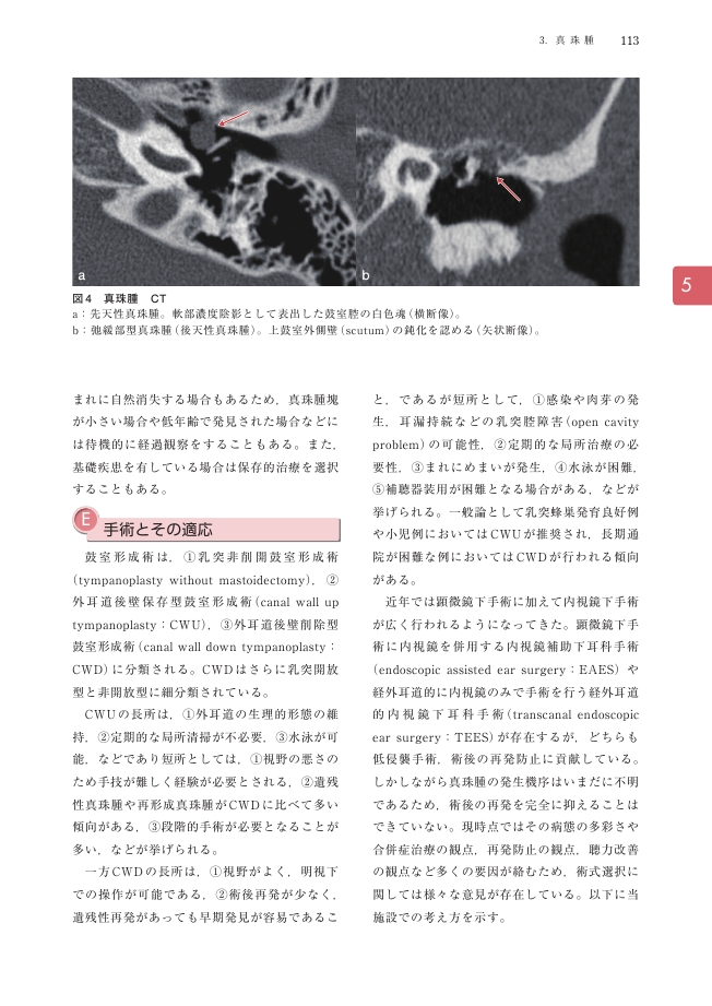 小児耳鼻咽喉科 第2版 小児耳鼻咽喉科 第2版