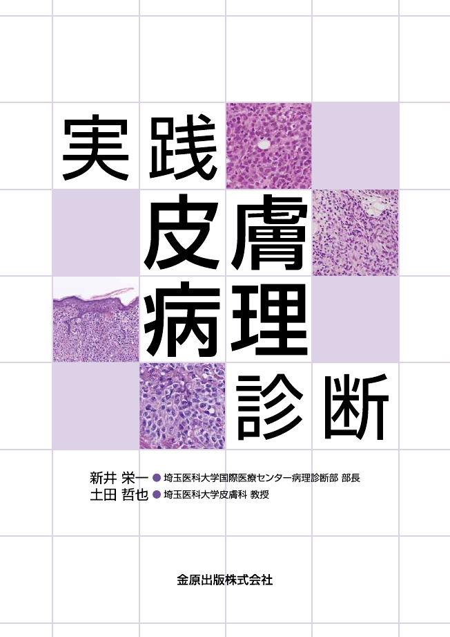 実践皮膚病理診断 金原出版