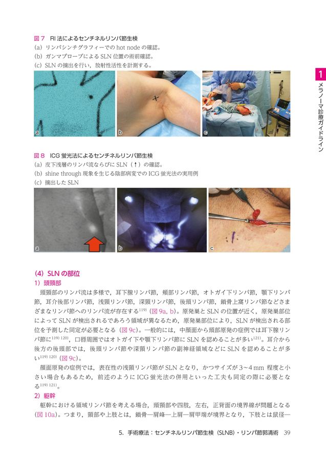 子宮頸癌・体癌センチネルリンパ節生検入門講座 早くスタートするための基本手技 子宮頸癌・体癌センチネルリンパ節生検入門講座 早くスタート