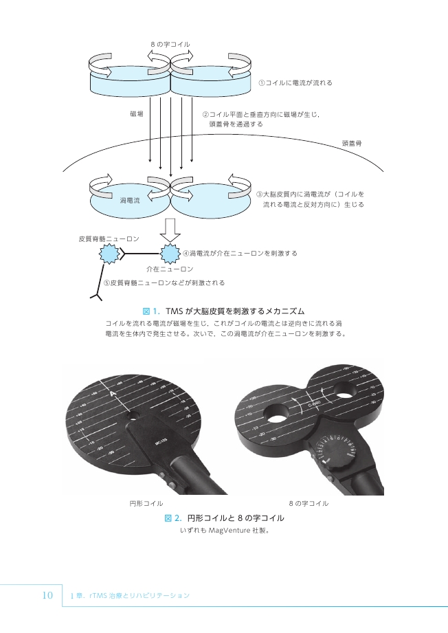 脳卒中後遺症に対するrTMS治療とリハビリテーション 脳卒中後遺症に対するrTMS治療とリハビリテーション