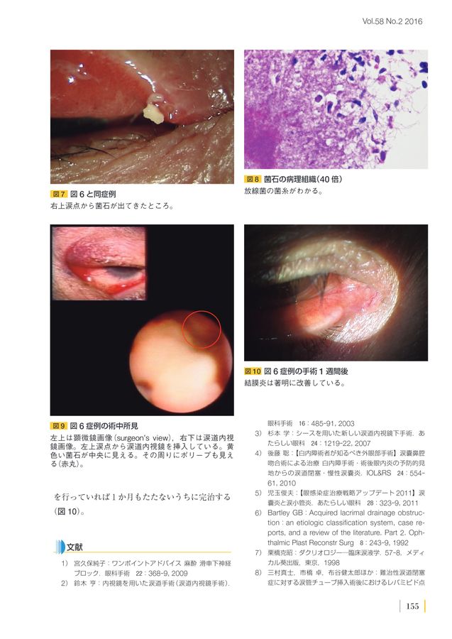 Amazon.co.jp: ダグリオロジー 臨床涙液学 : 栗原 克昭: 本