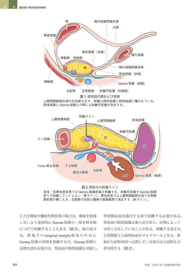 042152023055T 042152023055T