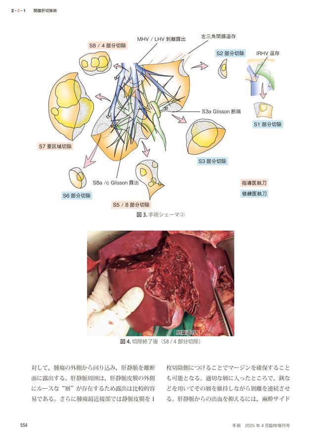 042152025045T