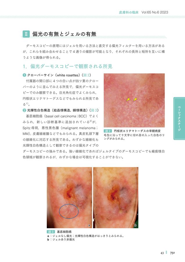 Amazon.co.jp: これで鑑別はOK! ダーモスコピー診断アトラスー似