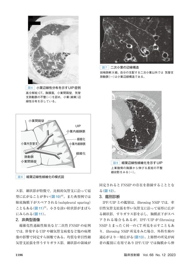 093492023125T